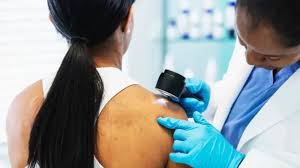 நேரடி சூரிய ஒளியால் புற்றுநோய் அபாயம்: காலை 10 முதல் மாலை 4 மணி வரை எச்சரிக்கையாக இருக்க நிபுணர் அறிவுறுத்தல்!